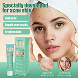 Oil Control Anti Acne Facial Care Gel