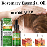 Rosemary Essential Oil for Preventing Hair Loss, Firming Hair, Nourishing Scalp, and Repairing Hair