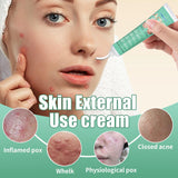 Oil Control Anti Acne Facial Care Gel