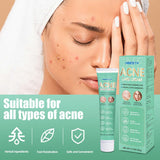 Oil Control Anti Acne Facial Care Gel