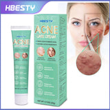 Oil Control Anti Acne Facial Care Gel